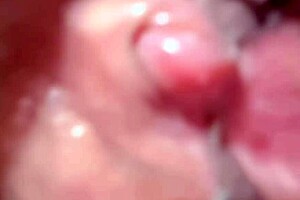 Amateur pink area 170 days after first time.