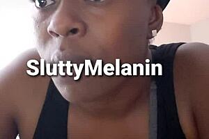 I got a yest infection on my penus and it hurts so bad