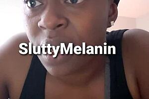 I got a yest infection on my penus and it hurts so bad