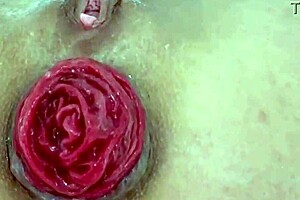 极端玩法特写毁坏肛门脱垂