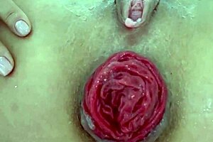 极端玩法特写毁坏肛门脱垂